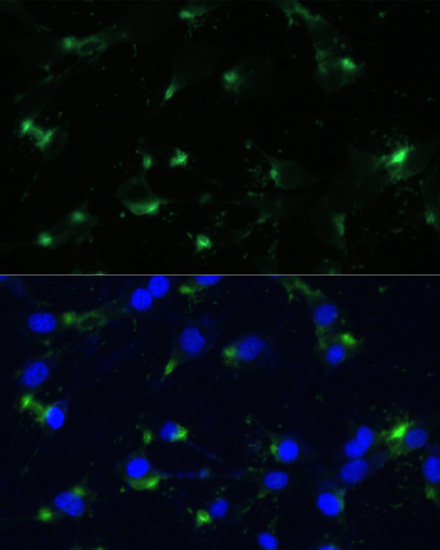 ENO1 Rabbit polyclonal antibody