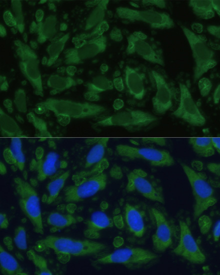 ENO1 Rabbit polyclonal antibody