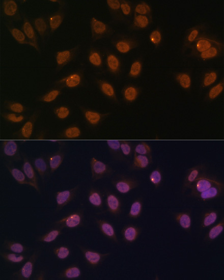 FOXG1 Rabbit polyclonal antibody