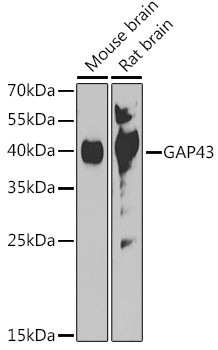 GAP43 Rabbit polyclonal antibody