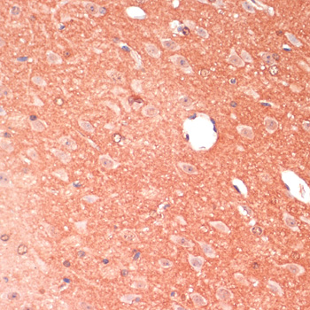 GAP43 Rabbit polyclonal antibody