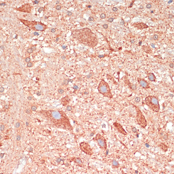 GAP43 Rabbit polyclonal antibody