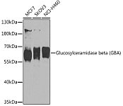 Western blot - Glucosylceramidase beta (GBA) Rabbit pAb (A16860)