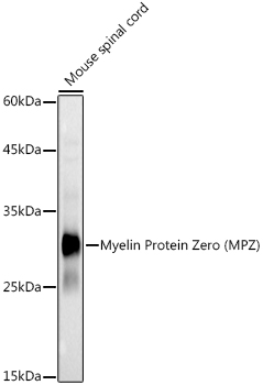 Myelin Protein Zero (MPZ) Rabbit polyclonal antibody