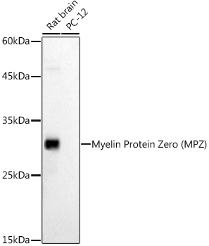 Myelin Protein Zero (MPZ) Rabbit polyclonal antibody