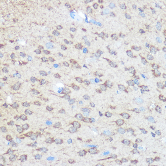 Huntingtin Rabbit polyclonal antibody