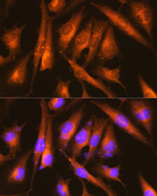 Huntingtin Rabbit polyclonal antibody