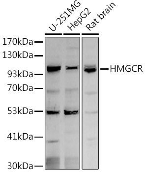 HMGCR Rabbit polyclonal antibody