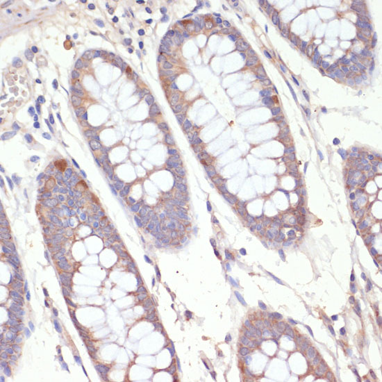 HMGCR Rabbit polyclonal antibody