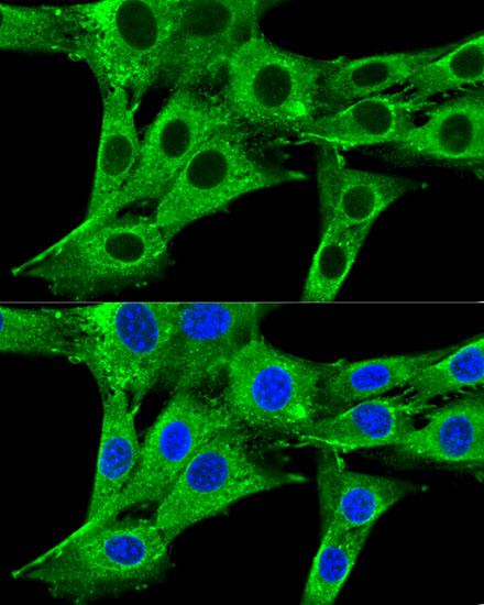 HMGCR Rabbit polyclonal antibody