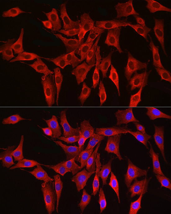HMGCR Rabbit polyclonal antibody