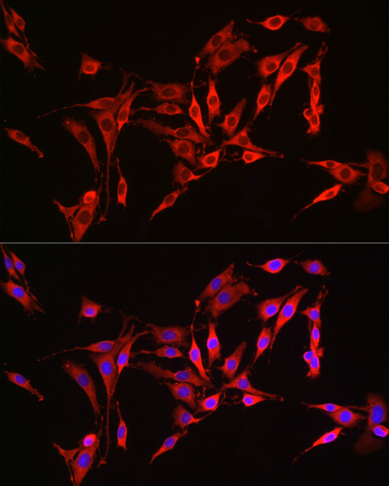 HMGCR Rabbit polyclonal antibody
