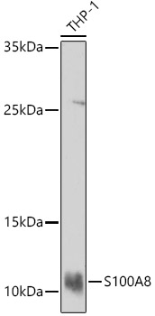 S100A8 Rabbit polyclonal antibody