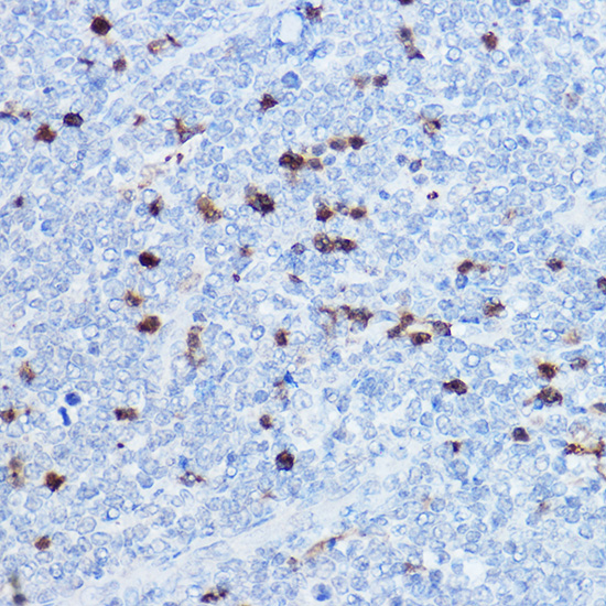 S100A8 Rabbit polyclonal antibody