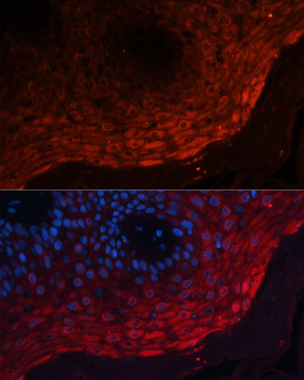 S100A8 Rabbit polyclonal antibody