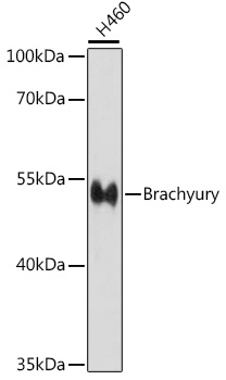 Brachyury Rabbit polyclonal antibody