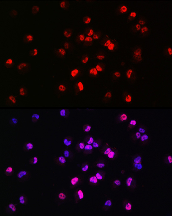 Brachyury Rabbit polyclonal antibody