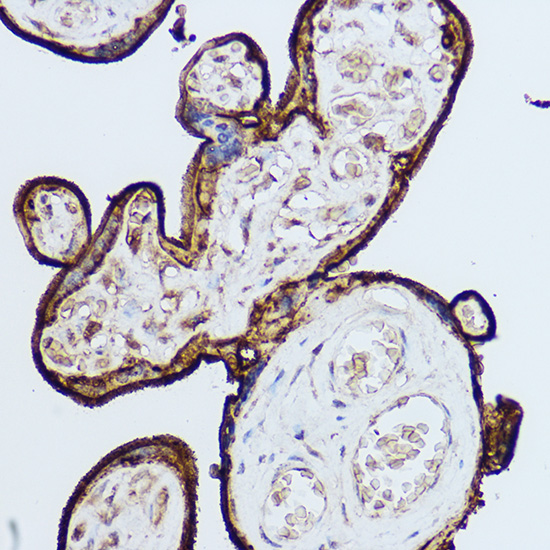 CD59 Rabbit polyclonal antibody
