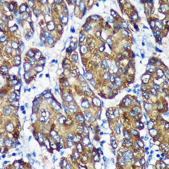 [KO Validated] NSDHL Rabbit polyclonal antibody