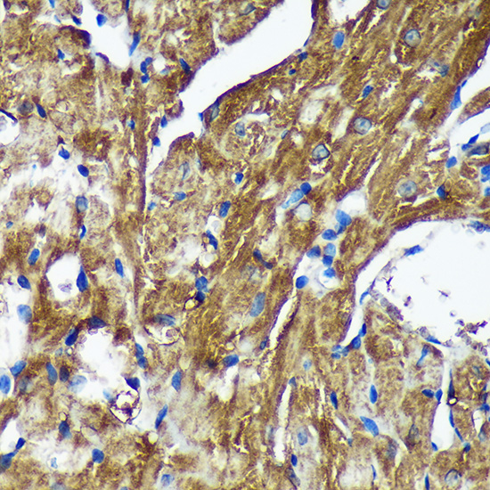 [KO Validated] NSDHL Rabbit polyclonal antibody
