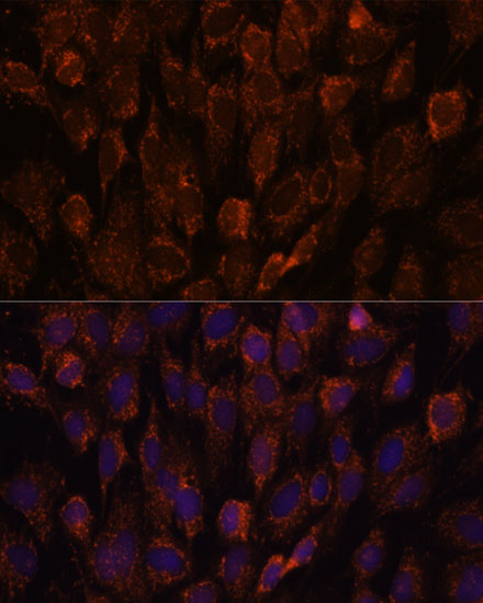 [KO Validated] NSDHL Rabbit polyclonal antibody