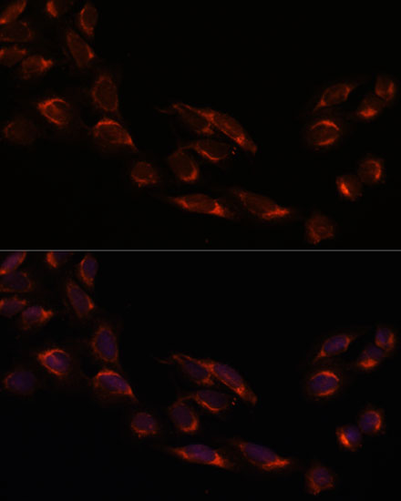 [KO Validated] NSDHL Rabbit polyclonal antibody