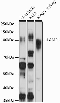 [KD Validated] LAMP1 Rabbit polyclonal antibody