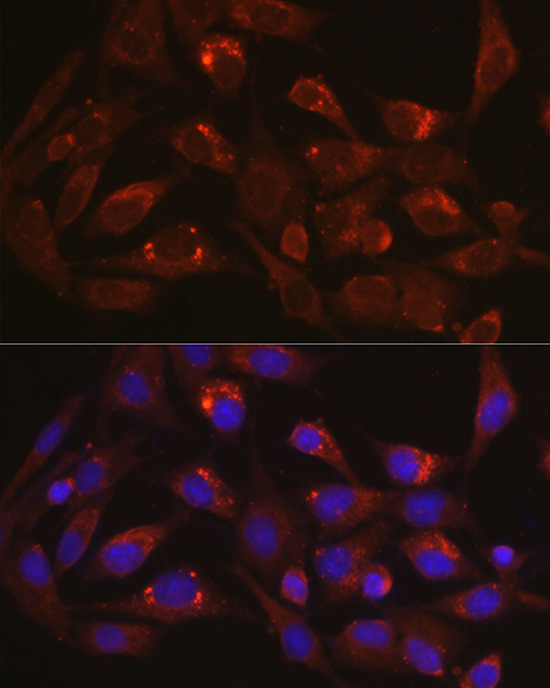 [KD Validated] LAMP1 Rabbit polyclonal antibody