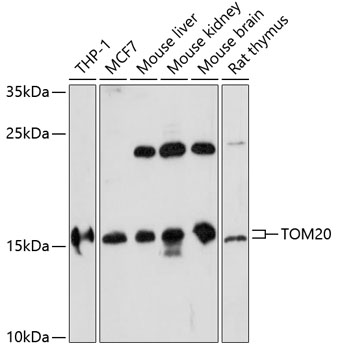 TOM20 Rabbit polyclonal antibody