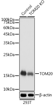 TOM20 Rabbit polyclonal antibody