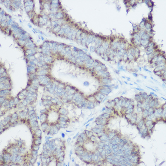 TOM20 Rabbit polyclonal antibody