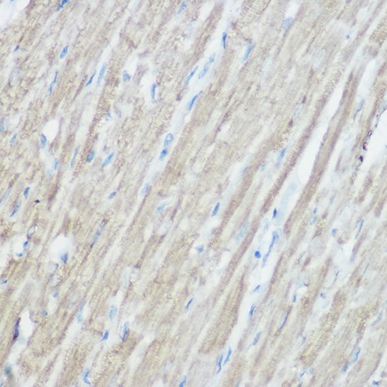 TOM20 Rabbit polyclonal antibody