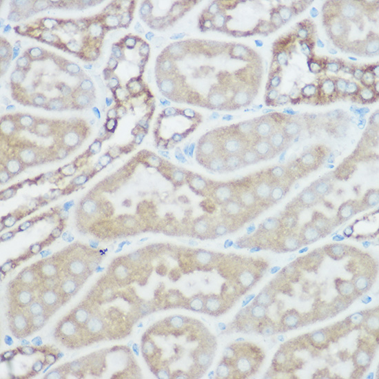 TOM20 Rabbit polyclonal antibody
