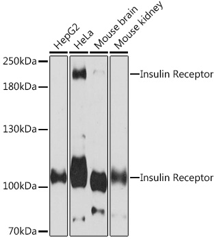 Insulin Receptor Rabbit polyclonal antibody