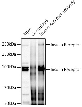 Insulin Receptor Rabbit polyclonal antibody