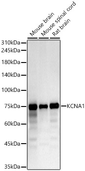 KCNA1 Rabbit polyclonal antibody