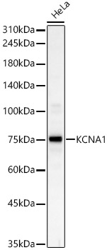 KCNA1 Rabbit polyclonal antibody