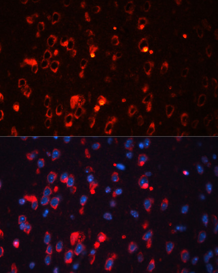 KCNA1 Rabbit polyclonal antibody