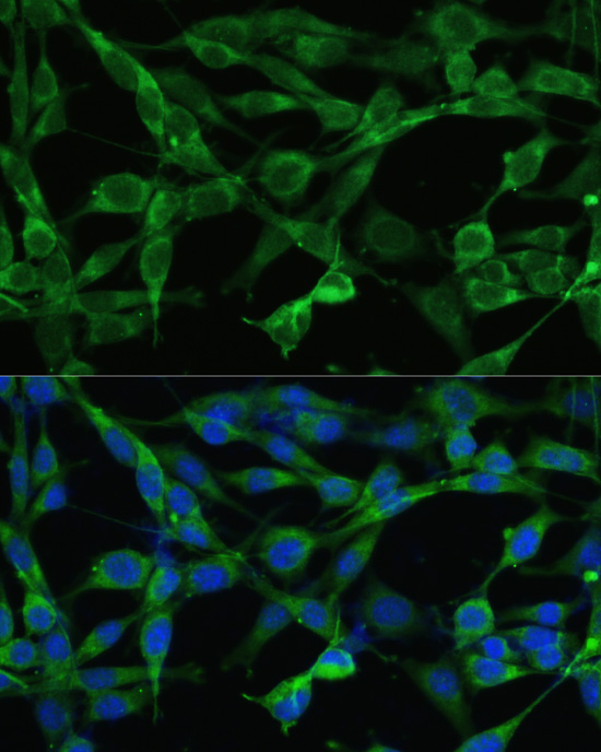 Smad3 Rabbit polyclonal antibody