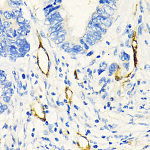 Western blot - CD146/MCAM Rabbit pAb (A16916)