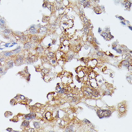 MAP3K4 Rabbit polyclonal antibody