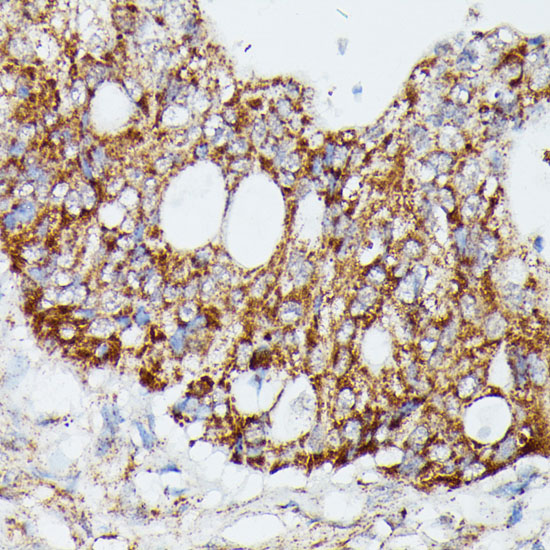 MAP3K4 Rabbit polyclonal antibody