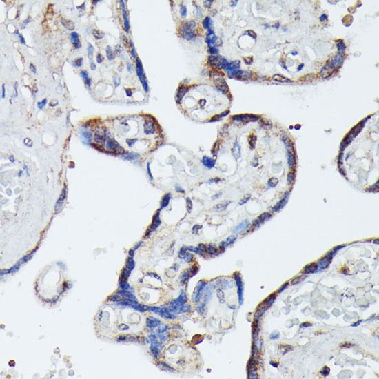MAP3K4 Rabbit polyclonal antibody