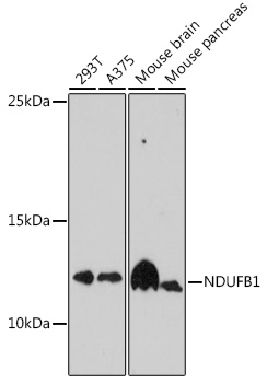 NDUFB1 Rabbit polyclonal antibody
