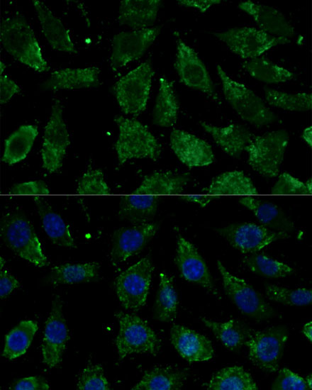 NDUFB1 Rabbit polyclonal antibody