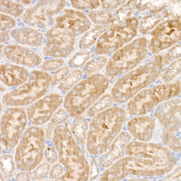 NDUFS1 Rabbit polyclonal antibody