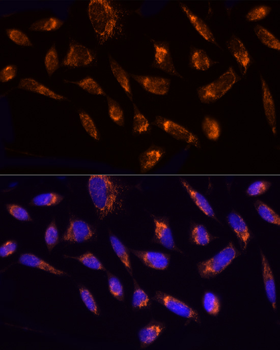 NDUFS1 Rabbit polyclonal antibody