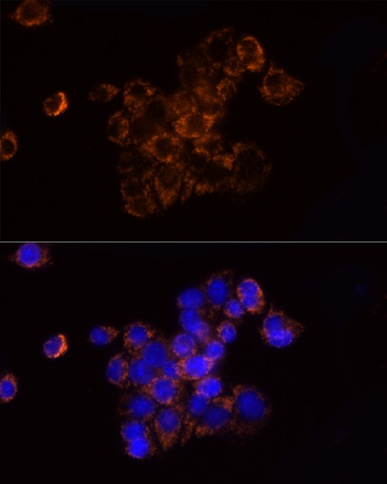 NDUFS1 Rabbit polyclonal antibody