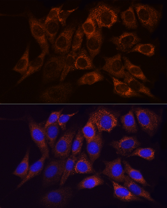 NDUFS1 Rabbit polyclonal antibody