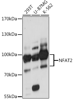 NFAT2 Rabbit polyclonal antibody